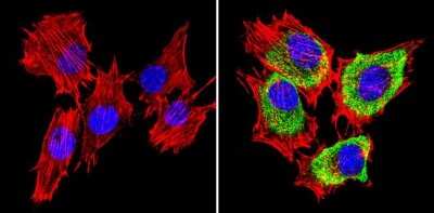 Immunocytochemistry/ Immunofluorescence: SREBP1 Antibody [NB100-74542]