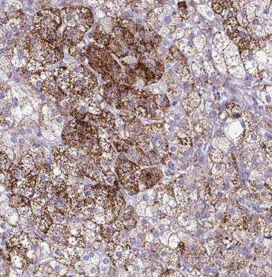 Immunohistochemistry-Paraffin: SREBP1 Antibody [NBP2-54707]