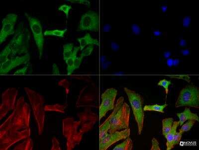 Immunocytochemistry/ Immunofluorescence: SREBP2 Antibody (1D2) - BSA Free [NBP1-54446]