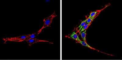 Immunocytochemistry/ Immunofluorescence: SREBP2 Antibody [NB100-74543]