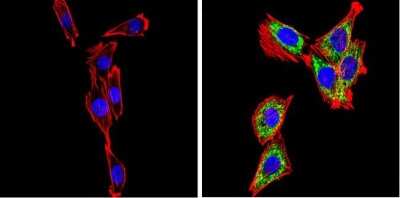 Immunocytochemistry/ Immunofluorescence: SREBP2 Antibody [NB100-74543]