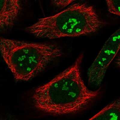 Immunocytochemistry/ Immunofluorescence: SRFBP1 Antibody [NBP1-88518]