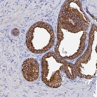 Immunohistochemistry-Paraffin: SRFBP1 Antibody [NBP1-88518]