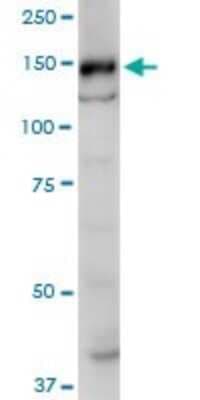 Western Blot: SRGAP1 Antibody (5D10) [H00057522-M07]