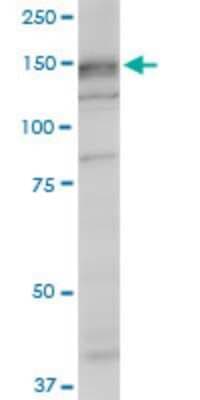 Western Blot: SRGAP1 Antibody (5D10) [H00057522-M07]