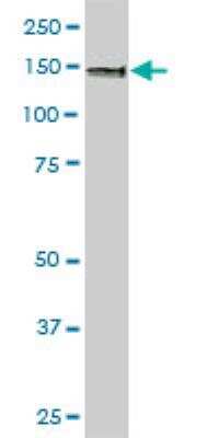 Western Blot: SRGAP1 Antibody (5D2) [H00057522-M03]