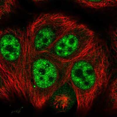 Immunocytochemistry/ Immunofluorescence: SRGAP1 Antibody [NBP2-13377]