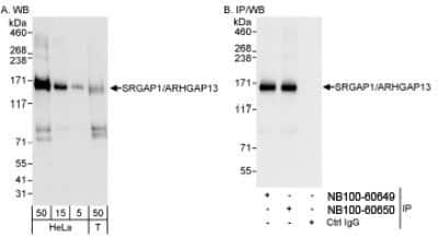 Western Blot: SRGAP1 Antibody [NB100-60650]
