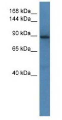 Western Blot: SRGAP1 Antibody [NBP1-79674]