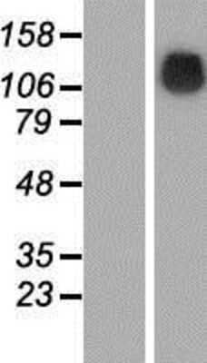 Western Blot: SRGAP1 Overexpression Lysate [NBP2-06611]