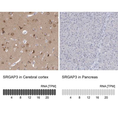Immunohistochemistry-Paraffin: SRGAP3 Antibody [NBP1-88831]