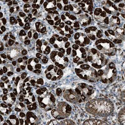 Immunohistochemistry-Paraffin: SRM Antibody [NBP1-80726]