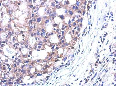 Immunohistochemistry-Paraffin: SRM Antibody [NBP2-20482]