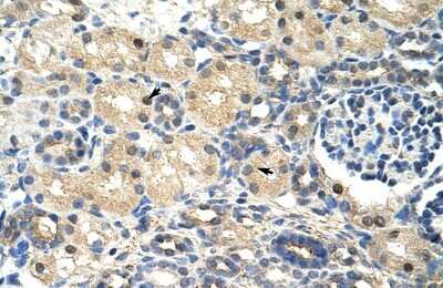Immunohistochemistry-Paraffin: SRP14 Antibody [NBP1-57413]