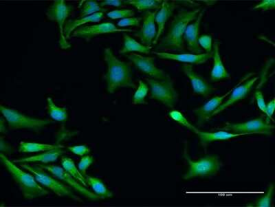 Immunocytochemistry/ Immunofluorescence: SRP19 Antibody [H00006728-D01P]