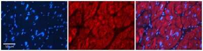 Immunohistochemistry: SRP19 Antibody [NBP1-57415]