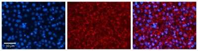Immunohistochemistry: SRP19 Antibody [NBP1-57415]