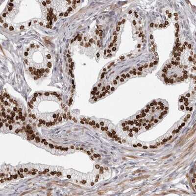 Immunohistochemistry-Paraffin: SRP19 Antibody [NBP1-89507]