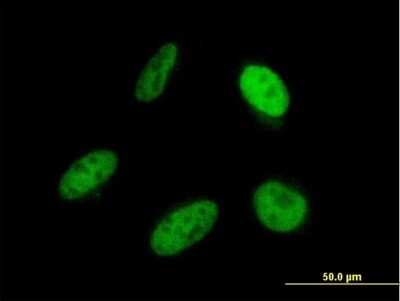 Immunocytochemistry/ Immunofluorescence: SRP68 Antibody (3A3) [H00006730-M03]