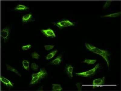Immunocytochemistry/ Immunofluorescence: SRPK1 Antibody (2E8) [H00006732-M02]