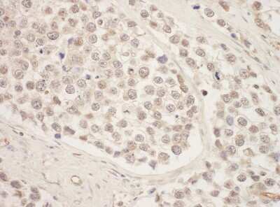 Immunohistochemistry-Paraffin: SRPK1 Antibody [NBP1-30108]