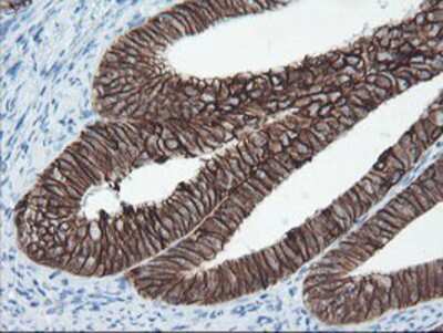 Immunohistochemistry-Paraffin: SRPRB Antibody (OTI1D9) [NBP2-02028]
