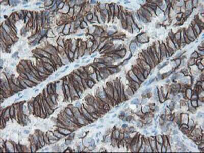 Immunohistochemistry-Paraffin: SRPRB Antibody (OTI1D9) [NBP2-02028]