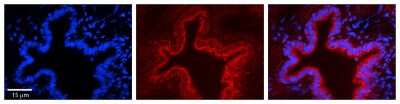 Immunohistochemistry: SRPRB Antibody [NBP1-59710]