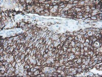 Immunohistochemistry: SRPRB Antibody (OTI1D9) - Azide and BSA Free [NBP2-74350]