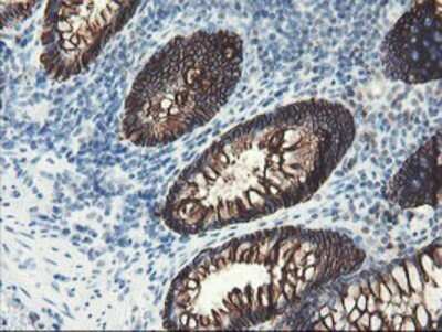 Immunohistochemistry: SRPRB Antibody (OTI1D9) - Azide and BSA Free [NBP2-74350]