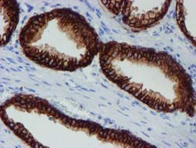 Immunohistochemistry: SRPRB Antibody (OTI1D9) - Azide and BSA Free [NBP2-74350]