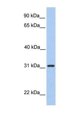 Western Blot: SRPRB Antibody [NBP1-59710]