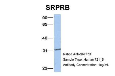 Western Blot: SRPRB Antibody [NBP1-59710]