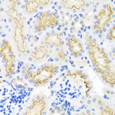 Immunohistochemistry-Paraffin: SRPX Antibody - BSA Free [NBP2-93855]