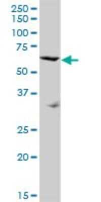 Western Blot: SRPX Antibody [H00008406-B01P]