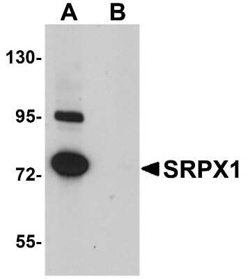Western Blot: SRPX AntibodyBSA Free [NBP1-77086]