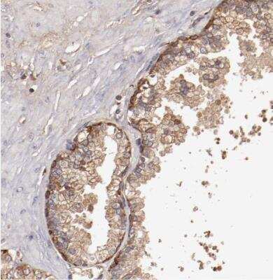Immunohistochemistry-Paraffin: SRRD Antibody [NBP1-83284]