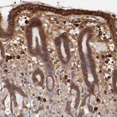 Immunohistochemistry-Paraffin: SRRD Antibody [NBP1-83284]