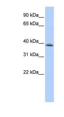 Western Blot: SRRD Antibody [NBP1-70715]