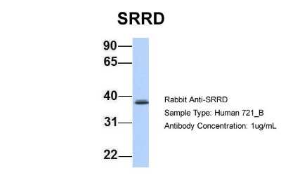 Western Blot: SRRD Antibody [NBP1-70715]