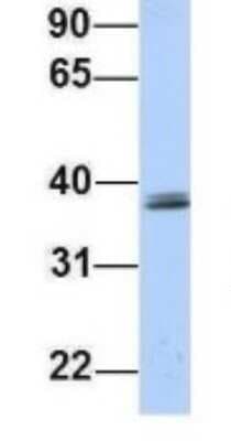 Western Blot: SRRD Antibody [NBP1-70715]