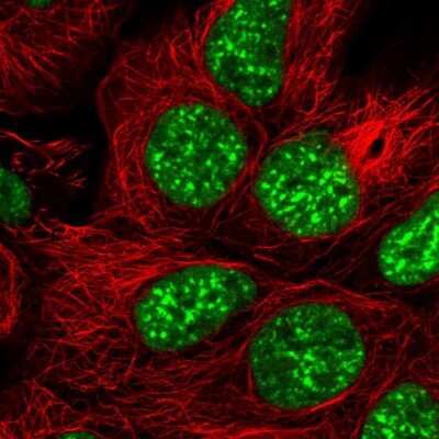 Immunocytochemistry/ Immunofluorescence: SRRM1 Antibody [NBP2-57064]