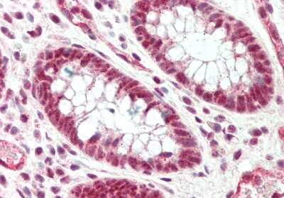 Immunohistochemistry-Paraffin: SRRM1 Antibody [NBP2-85821]