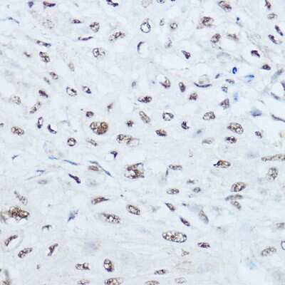 Immunohistochemistry-Paraffin: SRRM1 Antibody - Azide and BSA Free [NBP2-93715]