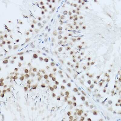 Immunohistochemistry-Paraffin: SRRM1 Antibody - Azide and BSA Free [NBP2-93715]