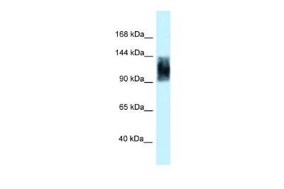 Western Blot: SRRM1 Antibody [NBP2-85821]