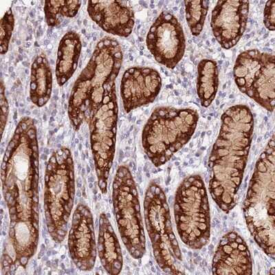 Immunohistochemistry-Paraffin: SRRM5 Antibody [NBP1-94187]