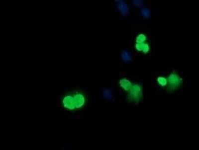 Immunocytochemistry/ Immunofluorescence: SRY Antibody (OTI3C8) - Azide and BSA Free [NBP2-74352]