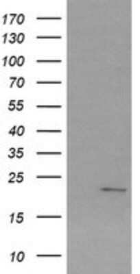 Western Blot: SRY Antibody (OTI3C8) [NBP2-45430]