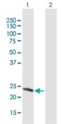 Western Blot: SRY Antibody [H00006736-B01P]